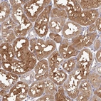 Immunohistochemical staining of human kidney shows moderate cytoplasmic positivity in cells in tubules.