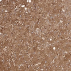 Immunohistochemical staining of human liver shows moderate cytoplasmic positivity in hepatocytes.