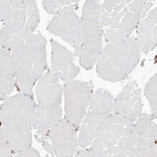 Immunohistochemical staining of human skeletal muscle shows no positivity in myocytes as expected.
