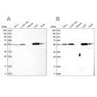 Western blot analysis using Anti-LAP3 antibody HPA029607 (A) shows similar pattern to independent antibody HPA029606 (B).