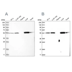 Western blot analysis using Anti-LAP3 antibody HPA029607 (A) shows similar pattern to independent antibody HPA029606 (B).