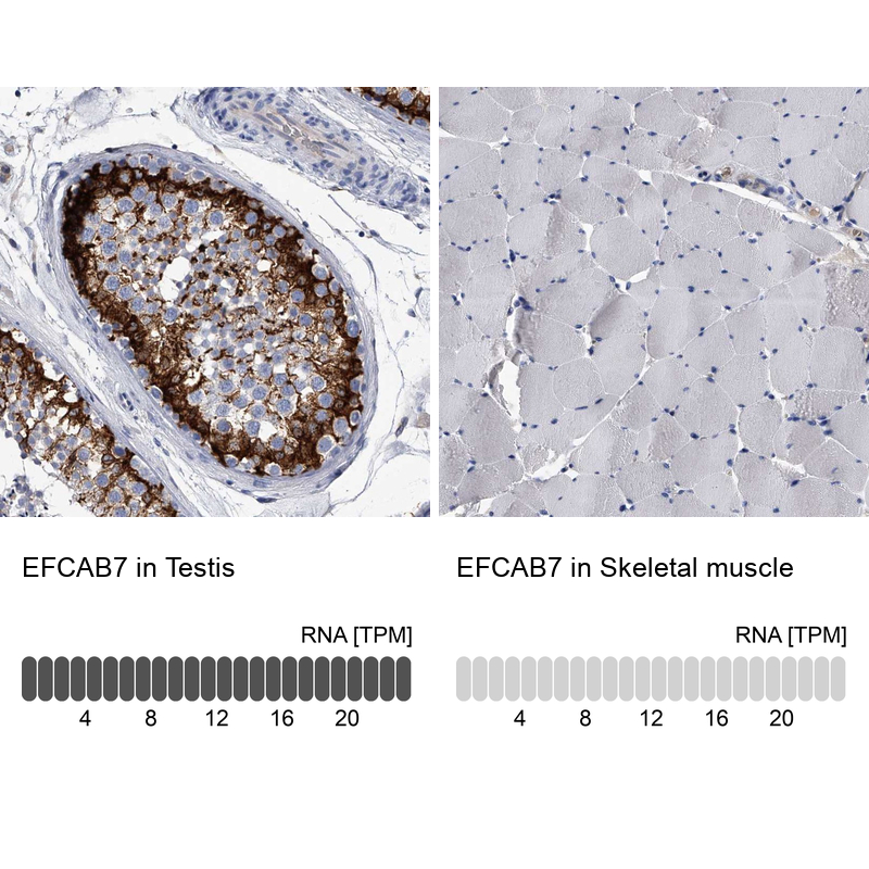 Anti-EFCAB7 Antibody