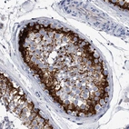 Immunohistochemical staining of human testis shows high expression.