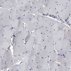 Immunohistochemical staining of human skeletal muscle shows low expression as expected.