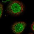 Immunofluorescent staining of human cell line A-431 shows localization to nucleoplasm & nuclear membrane.