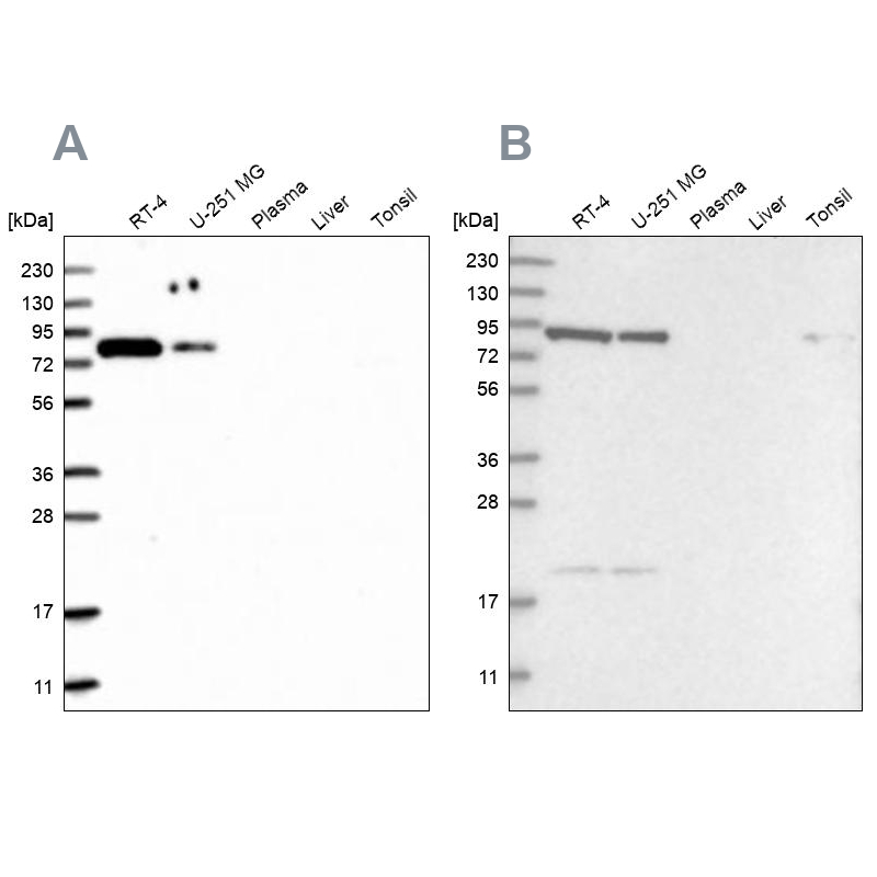 Anti-CHML Antibody