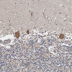 Immunohistochemical staining of human Cerebellum shows moderate cytoplasmic positivity in Purkinje cells.