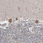 Immunohistochemical staining of human Cerebellum shows moderate cytoplasmic positivity in Purkinje cells.