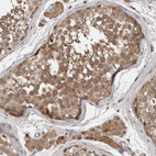 Immunohistochemical staining of human Testis shows moderate cytoplasmic positivity in cells in seminiferous ducts and Leydig cells.