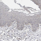 Immunohistochemical staining of human Skin shows very weak cytoplasmic positivity in squamous epithelial cells.