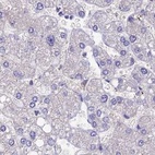 Anti-SNAP91 Antibody
