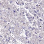 Immunohistochemical staining of human liver using Anti-SNAP91 antibody HPA029632.