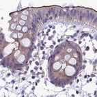 Immunohistochemical staining of human colon using Anti-SNAP91 antibody HPA029632.