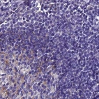 Immunohistochemical staining of human lymph node using Anti-SNAP91 antibody HPA029632.