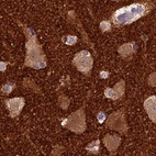 Immunohistochemical staining of human cerebral cortex using Anti-SNAP91 antibody HPA029632.