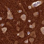 Immunohistochemical staining of human cerebral cortex using Anti-SNAP91 antibody HPA029632.