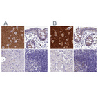Anti-SNAP91 Antibody