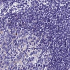 Immunohistochemical staining of human lymph node using Anti-SNAP91 antibody HPA029633.