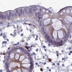Immunohistochemical staining of human colon using Anti-SNAP91 antibody HPA029633.