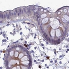 Immunohistochemical staining of human colon using Anti-SNAP91 antibody HPA029633.