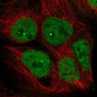 Anti-AFF4 Antibody