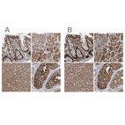 Anti-PSMB1 Antibody