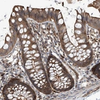 Immunohistochemical staining of human colon shows strong cytoplasmic positivity in glandular cells.