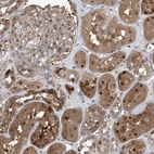 Immunohistochemical staining of human kidney shows moderate to strong cytoplasmic and nuclear positivity in cells in tubules.