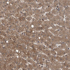 Anti-PSMB1 Antibody