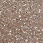 Immunohistochemical staining of human liver shows moderate to strong cytoplasmic positivity in hepatocytes.