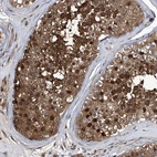 Immunohistochemical staining of human testis shows moderate to strong cytoplasmic and nuclear positivity in cells in seminiferous ducts.
