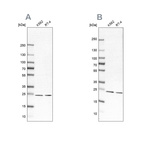 Anti-PSMB1 Antibody