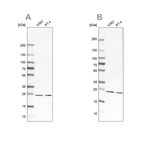 Western blot analysis using Anti-PSMB1 antibody HPA029635 (A) shows similar pattern to independent antibody HPA029637 (B).