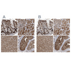 Anti-PSMB1 Antibody