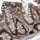 Anti-PSMB1 Antibody