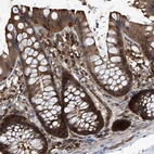 Immunohistochemical staining of human colon shows strong cytoplasmic positivity in glandular cells.