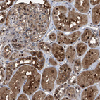 Immunohistochemical staining of human kidney shows moderate to strong cytoplasmic and nuclear positivity in cells in tubules.