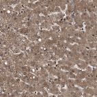 Immunohistochemical staining of human liver shows moderate to strong cytoplasmic positivity in hepatocytes.