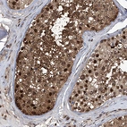 Immunohistochemical staining of human testis shows moderate to strong cytoplasmic and nuclear positivity in cells in seminiferous ducts.
