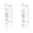 Western blot analysis using Anti-PSMB1 antibody HPA029637 (A) shows similar pattern to independent antibody HPA029635 (B).