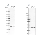 Western blot analysis using Anti-PSMB1 antibody HPA029637 (A) shows similar pattern to independent antibody HPA029635 (B).
