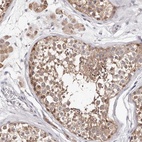 Anti-TYW3 Antibody
