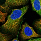 Immunofluorescent staining of human cell line U-2 OS shows positivity in cytoplasm.