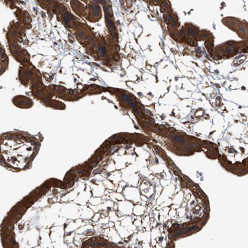 Anti-ANKRD34A Antibody
