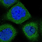 Immunofluorescent staining of human cell line A-431 shows localization to cytosol.
