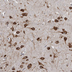 Immunohistochemical staining of human Cerebral cortex shows strong granular cytoplasmic positivity in neuronal cells.