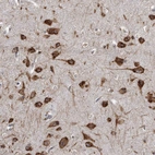 Immunohistochemical staining of human Cerebral cortex shows strong granular cytoplasmic positivity in neuronal cells.