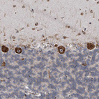 Immunohistochemical staining of human Cerebellum shows strong granular cytoplasmic positivity in Purkinje cells.