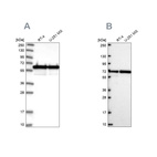 Western blot analysis using Anti-CCDC47 antibody HPA029674 (A) shows similar pattern to independent antibody HPA072573 (B).