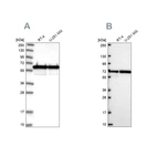 Western blot analysis using Anti-CCDC47 antibody HPA029674 (A) shows similar pattern to independent antibody HPA072573 (B).
